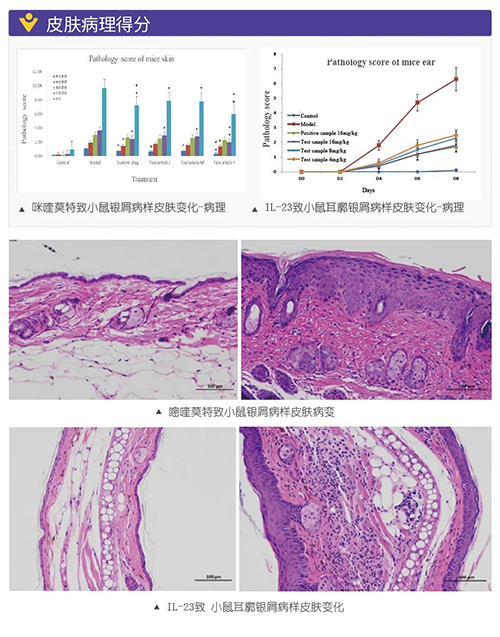 咪喹莫特致小鼠银屑病样皮肤变化病理得分