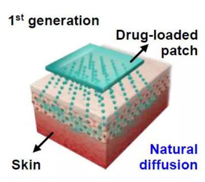 第一代透皮给药技术：通过药物的自然扩散.jpg