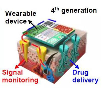 第四代透皮给药技术：在可穿戴设备的帮助下，用于患者定制治疗.jpg